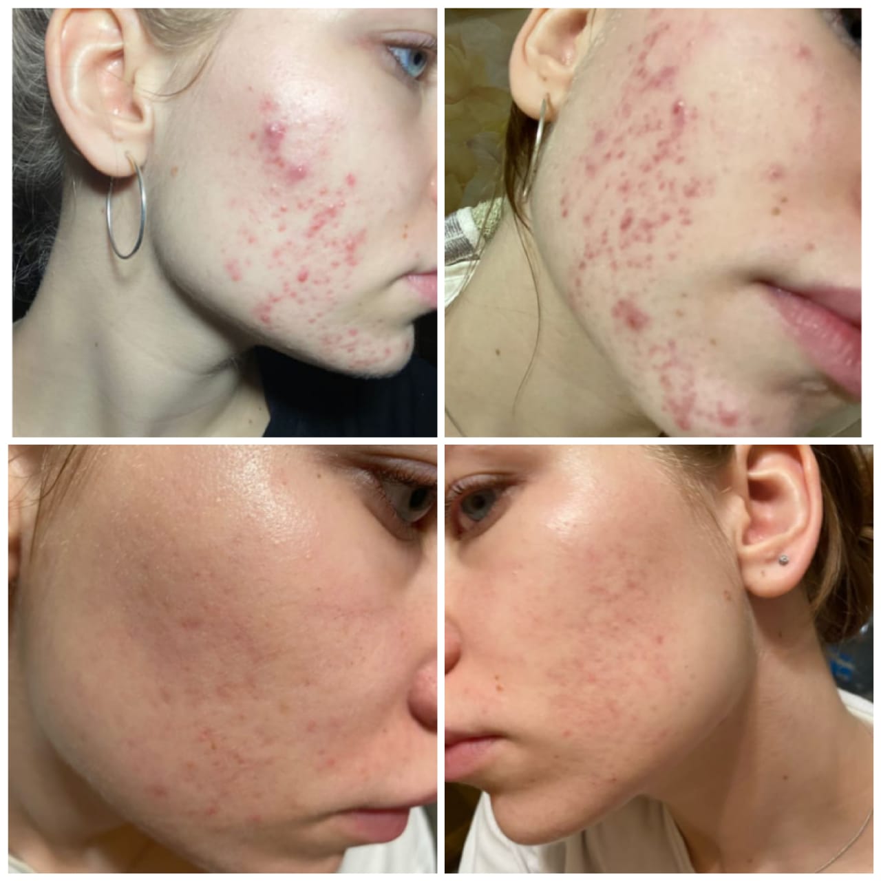 Косметолог Яна Бабичева 11 whatsapp image 2025 04 13 at 18.55.07 1