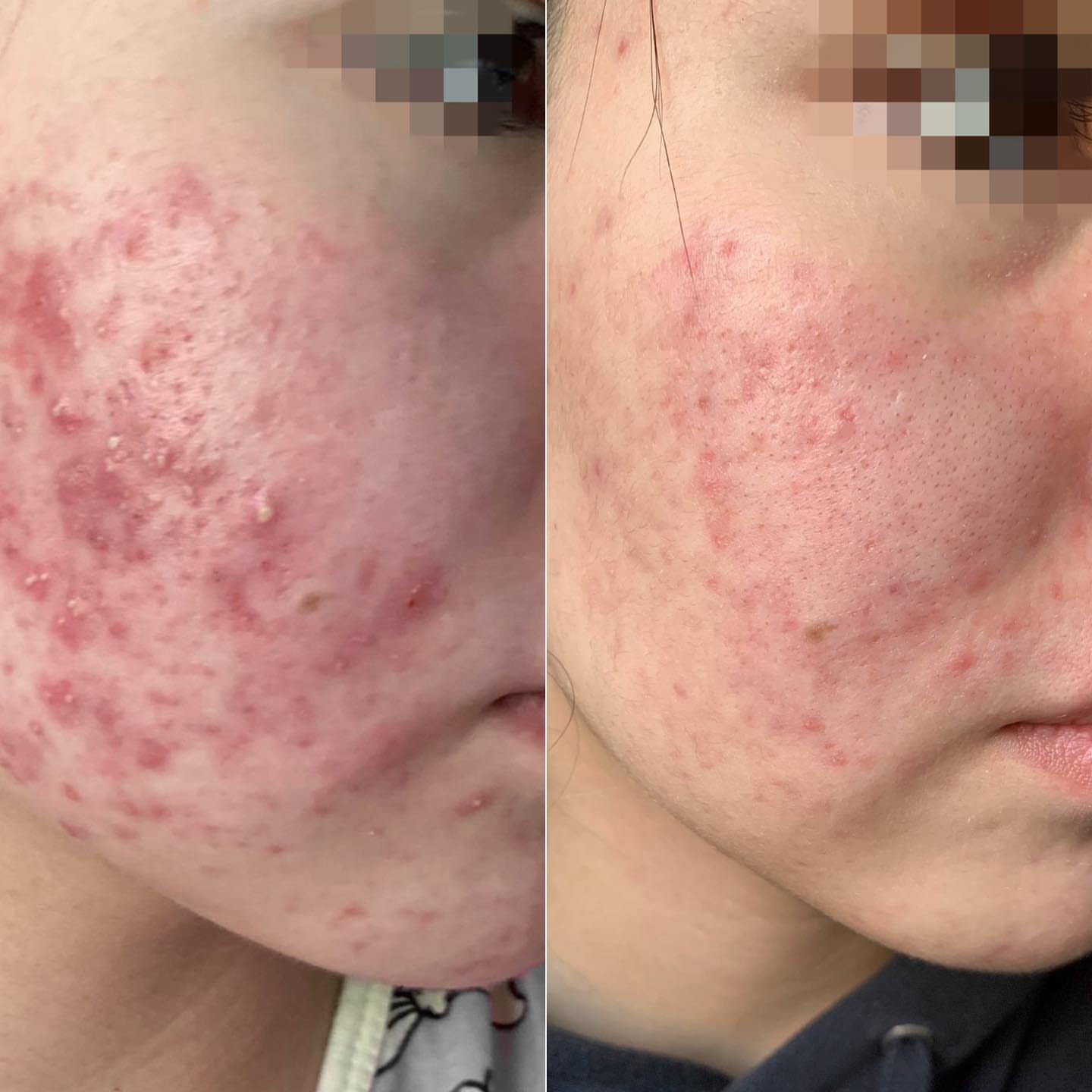 Уход за кожей лица для девочек-подростков: советы косметолога 5 whatsapp image 2025 04 13 at 18.55.16